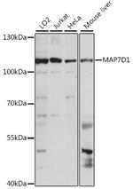 MAP7D1 Antibody in Western Blot (WB)