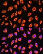 LMBRD1 Antibody in Immunocytochemistry (ICC/IF)