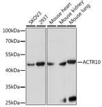 ACTR10 Antibody in Western Blot (WB)