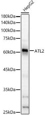 ATL2 Antibody in Western Blot (WB)