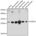 CD99L2 Antibody in Western Blot (WB)