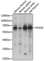 PUS10 Antibody in Western Blot (WB)