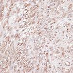 Laminin gamma-1 Antibody in Immunohistochemistry (Paraffin) (IHC (P))