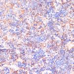 CACNB2 Antibody in Immunohistochemistry (Paraffin) (IHC (P))