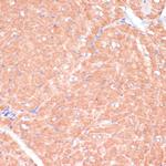 CACNB2 Antibody in Immunohistochemistry (Paraffin) (IHC (P))