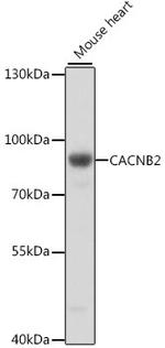 CACNB2 Antibody in Western Blot (WB)