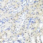 TRIM27 Antibody in Immunohistochemistry (Paraffin) (IHC (P))