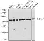 SLC28A2 Antibody in Western Blot (WB)