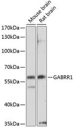 GABRR1 Antibody in Western Blot (WB)