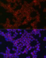 CSF1R Antibody in Immunocytochemistry (ICC/IF)