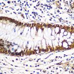 14-3-3 gamma Antibody in Immunohistochemistry (Paraffin) (IHC (P))