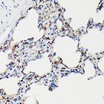 SFTPA1 Antibody in Immunohistochemistry (Paraffin) (IHC (P))