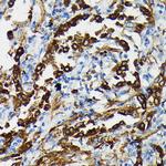 SFTPA1 Antibody in Immunohistochemistry (Paraffin) (IHC (P))