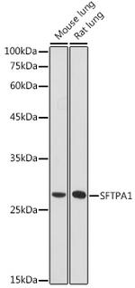 SFTPA1 Antibody in Western Blot (WB)