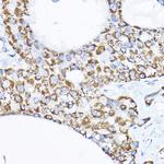 SAMM50 Antibody in Immunohistochemistry (Paraffin) (IHC (P))