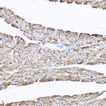 SAMM50 Antibody in Immunohistochemistry (Paraffin) (IHC (P))