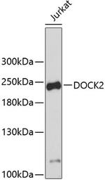 DOCK2 Antibody in Western Blot (WB)