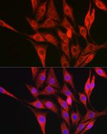 Collagen III Antibody in Immunocytochemistry (ICC/IF)