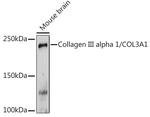 Collagen III Antibody in Western Blot (WB)