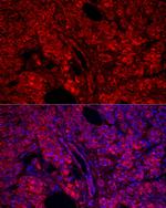 Carboxypeptidase A1 Antibody in Immunocytochemistry (ICC/IF)