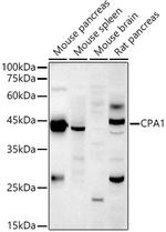 Carboxypeptidase A1 Antibody in Western Blot (WB)