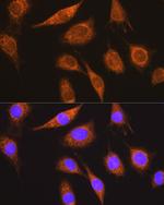 MUT Antibody in Immunocytochemistry (ICC/IF)