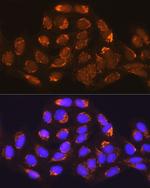 MUT Antibody in Immunocytochemistry (ICC/IF)