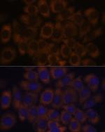 RPL23A Antibody in Immunocytochemistry (ICC/IF)