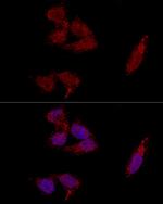 RPL23A Antibody in Immunocytochemistry (ICC/IF)