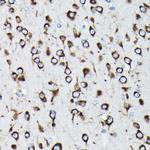 RPL23A Antibody in Immunohistochemistry (Paraffin) (IHC (P))