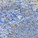 RPL23A Antibody in Immunohistochemistry (Paraffin) (IHC (P))