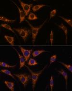 STCH Antibody in Immunocytochemistry (ICC/IF)