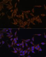 UBE2L3 Antibody in Immunocytochemistry (ICC/IF)