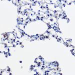 UBE2L3 Antibody in Immunohistochemistry (Paraffin) (IHC (P))