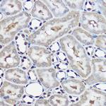 UBE2L3 Antibody in Immunohistochemistry (Paraffin) (IHC (P))