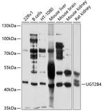 UGT2B4 Antibody in Western Blot (WB)