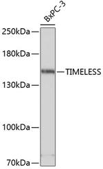 TIMELESS Antibody in Western Blot (WB)