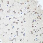 SAP18 Antibody in Immunohistochemistry (Paraffin) (IHC (P))