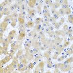 PCID1 Antibody in Immunohistochemistry (Paraffin) (IHC (P))