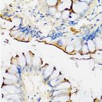 CRTAP Antibody in Immunohistochemistry (Paraffin) (IHC (P))