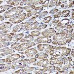 ADRM1 Antibody in Immunohistochemistry (Paraffin) (IHC (P))