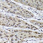 ADRM1 Antibody in Immunohistochemistry (Paraffin) (IHC (P))