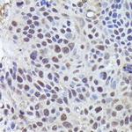 CRCP Antibody in Immunohistochemistry (Paraffin) (IHC (P))