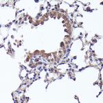 CRCP Antibody in Immunohistochemistry (Paraffin) (IHC (P))