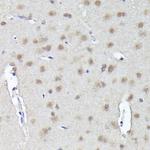 CRCP Antibody in Immunohistochemistry (Paraffin) (IHC (P))