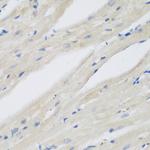 NAT13 Antibody in Immunohistochemistry (Paraffin) (IHC (P))