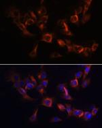 ARL13B Antibody in Immunocytochemistry (ICC/IF)