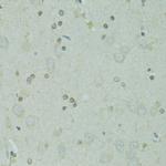 GTF2H2C Antibody in Immunohistochemistry (Paraffin) (IHC (P))