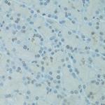 GTF2H2C Antibody in Immunohistochemistry (Paraffin) (IHC (P))