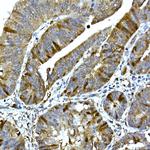 RRM2 Antibody in Immunohistochemistry (Paraffin) (IHC (P))